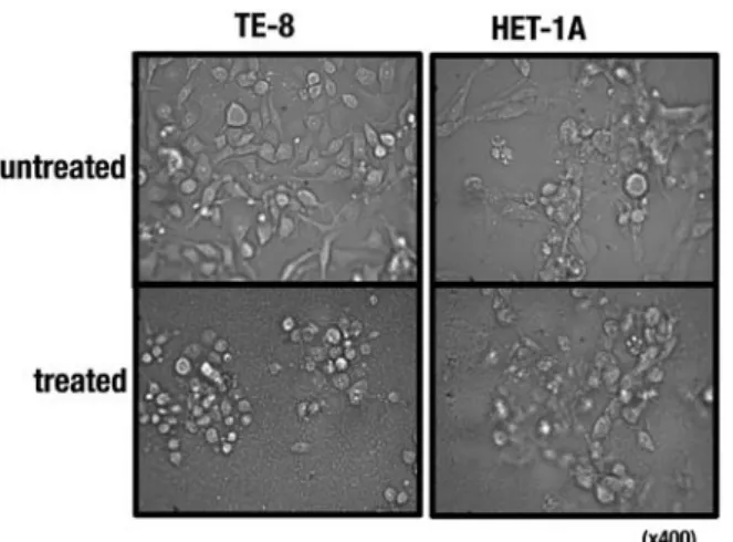 Figure 2. Morphological changes of esophageal cells after treatment with  the C. zedoaria extract