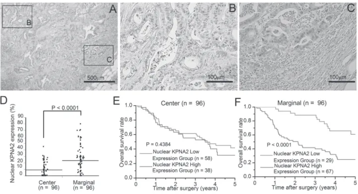 Figure  1I). The multivariate regression analysis revealed that  high expression of nuclear KPNA2 in 179 GC samples was an  independent prognostic factor (P  =  0.023) as were tumor depth  (P = 0.045), lymph node metastasis (P = 0.0013) and venous  inva-si