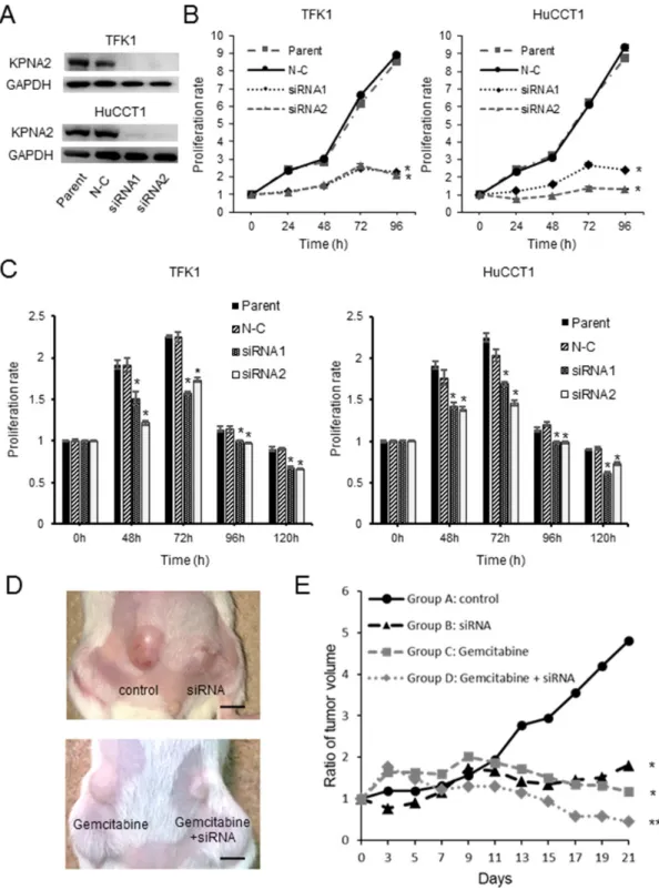 Figure 3: In vitro and in vivo analysis of karyopherin-α2 (KPNA2) function in cholangiocarcinoma cell lines transfected  with KPNA2-specific siRNAs