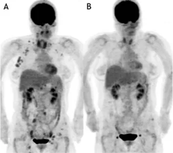 Fig. 1 　 Responder FDG-PET ╱ CT images