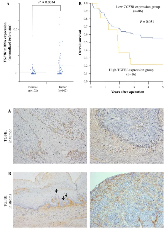 FIG. 1 Clinical significance of TGFBI mRNA expression in clinical ESCC samples.