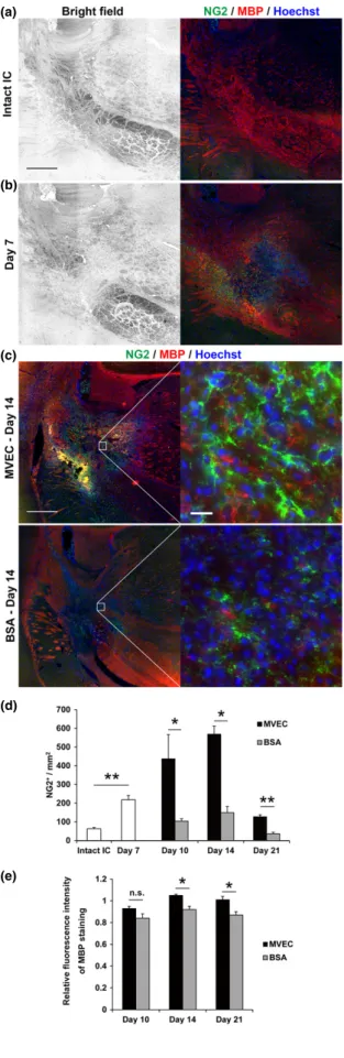 Fig. 3 Microvascular endothelial cell (MVEC) transplantation increased the number of oligodendrocyte precursor cells (OPCs) and ﬂuorescence intensity of myelin basic protein (MBP) staining