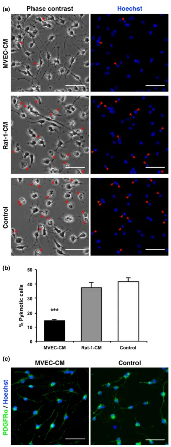 Fig. 6 Conditioned medium (CM) from microvascular endothelial cell (MVEC) cultures reduced apoptosis of oligodendrocyte precursor cells (OPCs) but did not promote their maturation in vitro