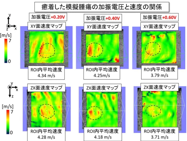 Fig. 5-5-3  癒着した模擬腫瘍の加振電圧と速度の関係 