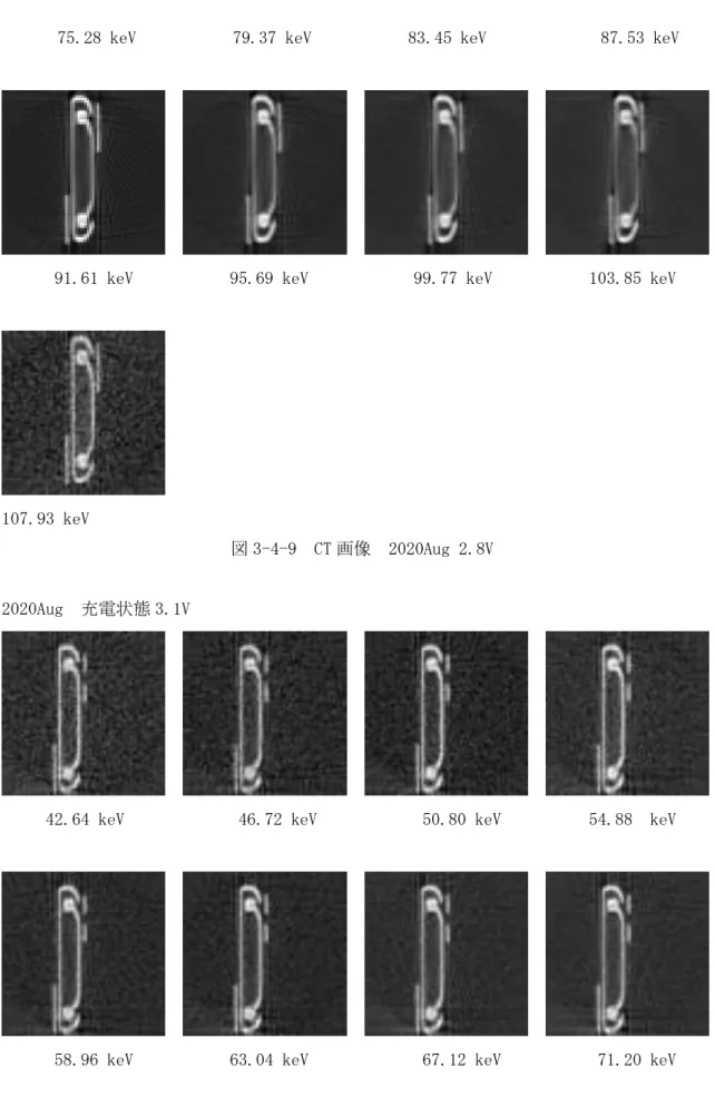 図 3-4-9  CT 画像  2020Aug 2.8V    