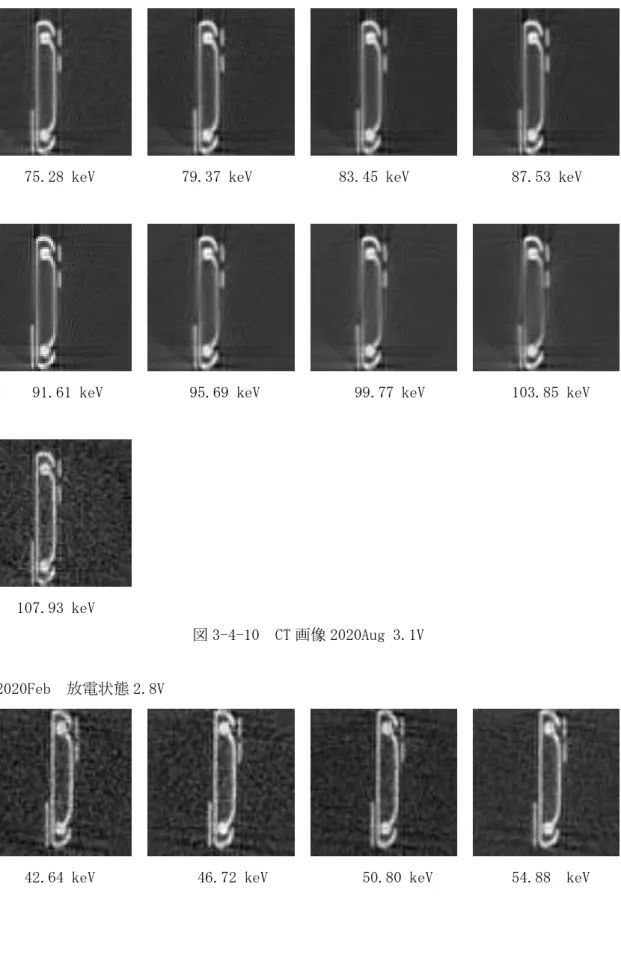 図 3-4-10  CT 画像 2020Aug 3.1V     