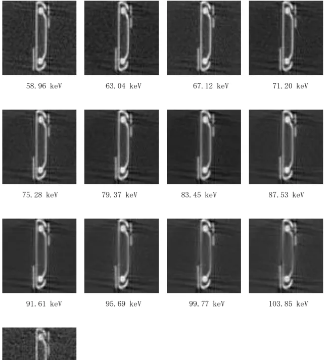 図 3-4-11  CT 画像  2020Feb 2.8V    