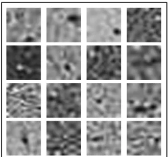 Figure 3 shows the several examples of feature extract vectors of φ k . Since the HRCT ROI images are not sort of natural images, the obtained bases φ k are not similar to the Gabor filters that can be obtained by the sparse coding with natural scene proce