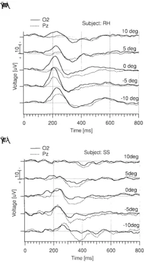 Fig. 4 The latencies of the negative peaks to RDSs and monocular-cue stimuli.