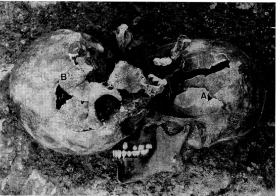Fig,  1.  Discovery  of  the  skulls  with  the  upper  cervical  vertebrae  of  males  A  (right)  and  B    (left)  buried  together  into  one  and  the  same  pit  in  Imakoji-nishi  site,  Kamakura