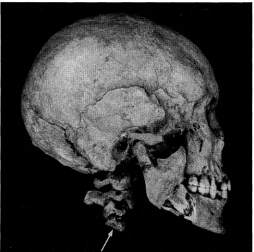 Fig. 5.  Right  lateral  aspect  of  the  skull  with  the  1st  to  4th  cervical  vertebrae  of  male  B