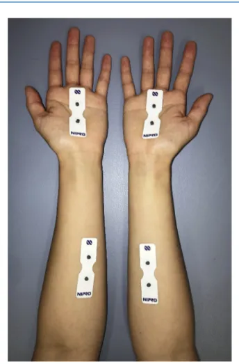 Figure 3. Photography of the measurement sites for the PainVision unit. Proximomedial sections of the flexion side of the bilateral forearms and palms were used to calculate the current perception threshold.