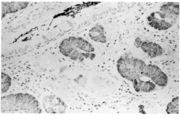 Fig.  8.   MHPC-1  stained  mucous  cells  of  bronchial gland.  Counterstained  with  hematoxylin.