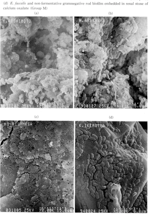 Fig.  1  SEM  of  cut  surface  of  urinary  stones:  (a)  S.  epidermidis  biofilm  embedded  in  apatite bladder  stone  (Group  I),  (b)  K