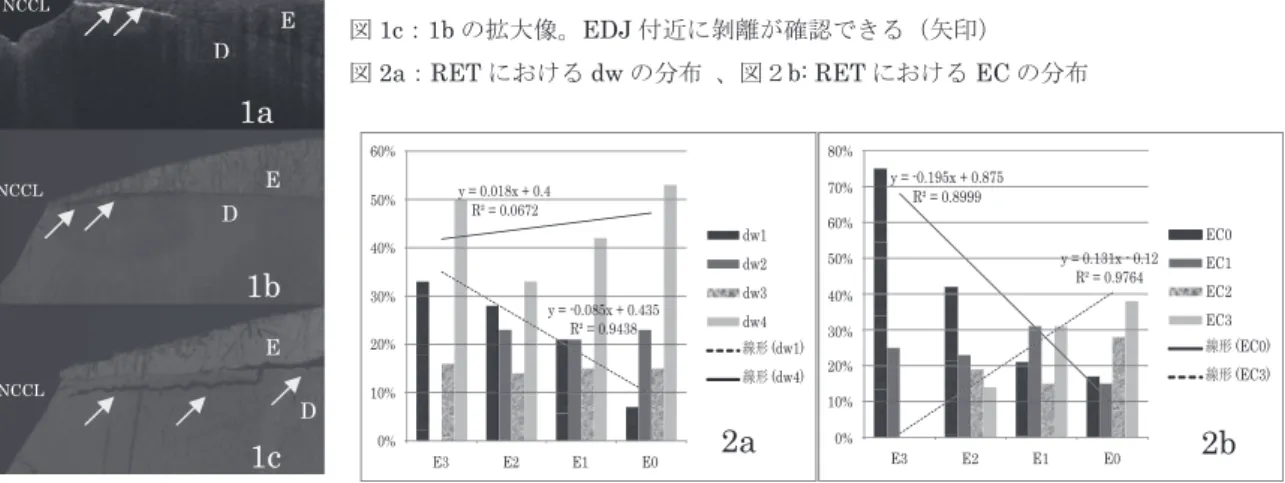 図 1a：NCCL の SS-OCT 画像、E：エナメル質、D：象牙質。図 1b：CLSM 画像、 図 1c：1b の拡大像。EDJ 付近に剝離が確認できる（矢印）  図 2a：RET における dw の分布  、図２b: RET における EC の分布  1a  1b  1c  2a  2b E DNCCL E NCCL D E NCCL Dy = -0.085x + 0.435R² = 0.9438y = 0.018x + 0.4R² = 0.06720%10%20%30%40%50%60%E3E2E1