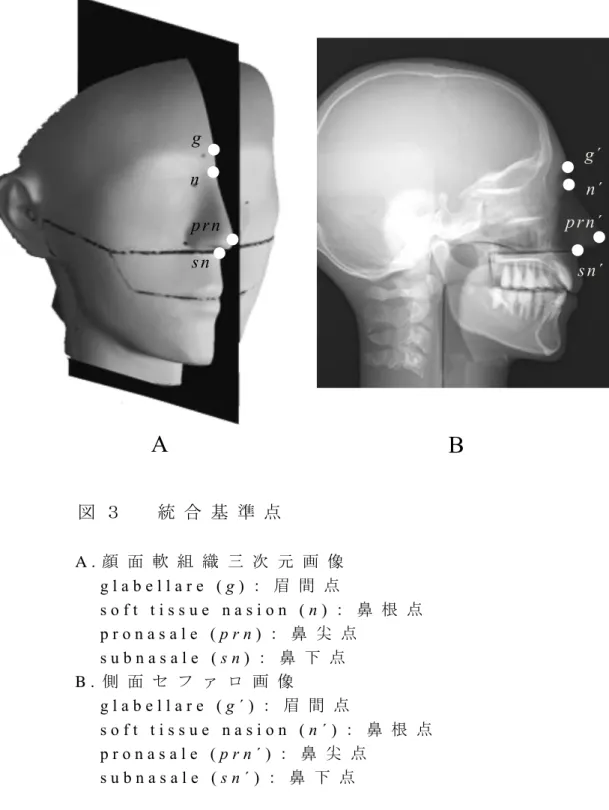 図 ３ 統 合 基 準 点 A . 顔 面 軟 組 織 三 次 元 画 像 g l a b e l l a r e   ( g ) ： 眉 間 点 s o f t   t i s s u e   n a s i o n   ( n ) ： 鼻 根 点 p r o n a s a l e   ( p r n ) ： 鼻 尖 点 s u b n a s a l e   ( s n ) ： 鼻 下 点 B 