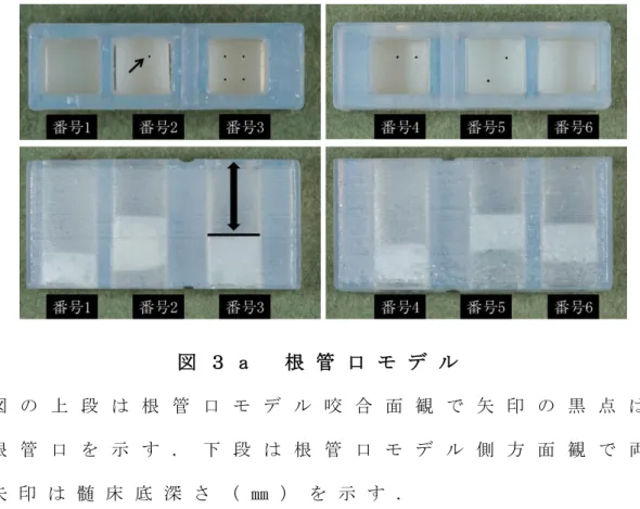 図 ３ a   根 管 口 モ デ ル  