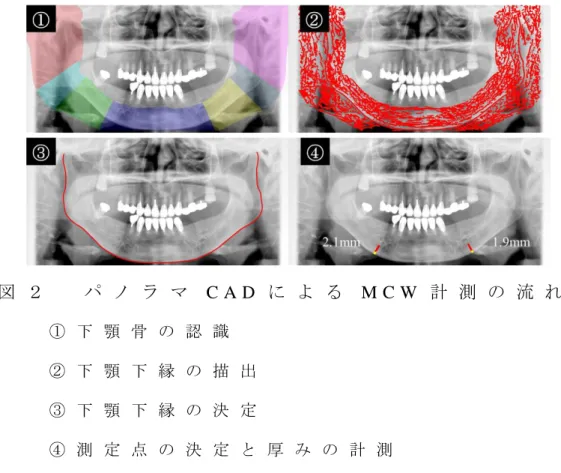 図 ２   パ ノ ラ マ C A D に よ る M C W 計 測 の 流 れ