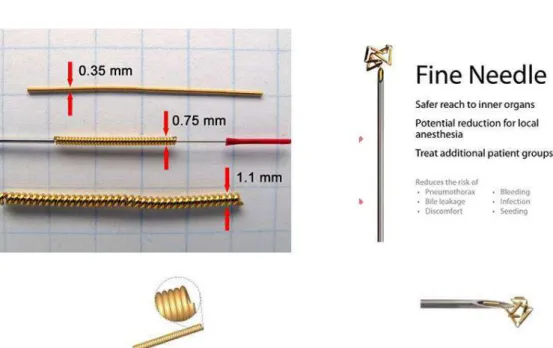 Figure 1. Marker characteristics. The Gold Anchor can be used with needles as thin as 25G and placed spherically