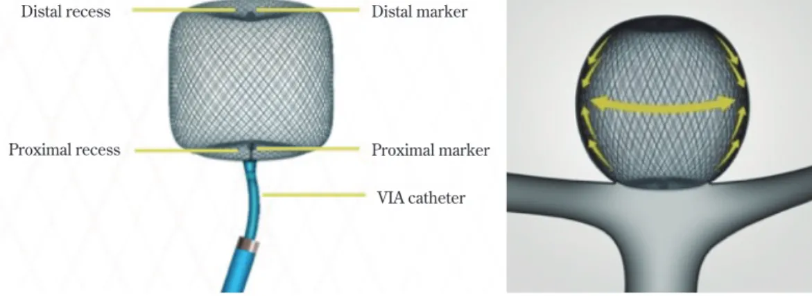 Fig. 2 Schema of WEB （Courtesy by Sequent Medical）
