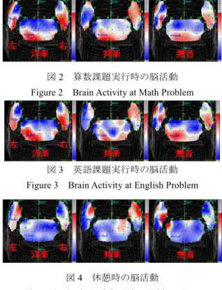 Figure 2  Brain Activity at Math Problem 