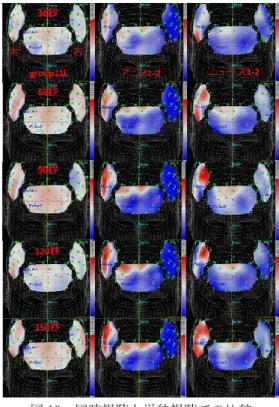 Figure 10  Comparison of Multiple or Single   