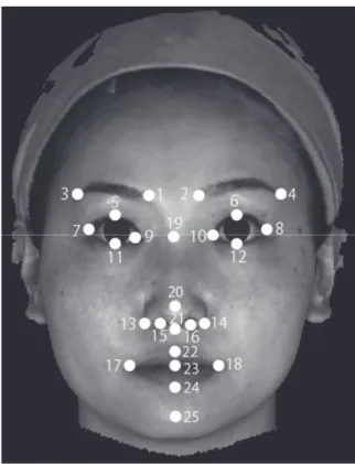 Figure 2. Average face under the eyes created based on  3D  facial  images  in  the  maxillary  incisor  protrusion  and  control  groups  (A,  Maxillary  nincisor  protrusion  group  image; B, Control group image; left, frontal image; middle,  three-quart