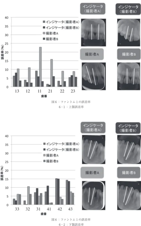 図 6 ：ファントム 1 の誤差率 6 ‑ 1 ：上顎誤差率