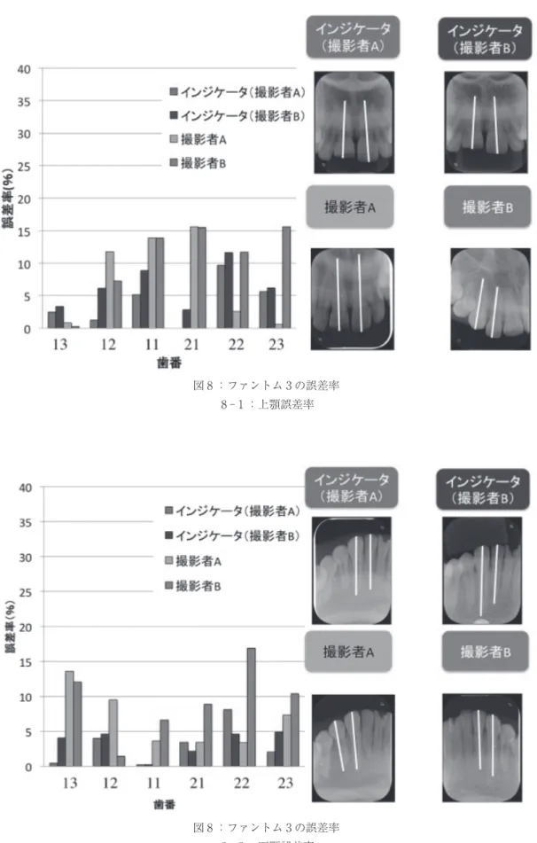 図 8 ：ファントム 3 の誤差率 8 ‑ 1 ：上顎誤差率