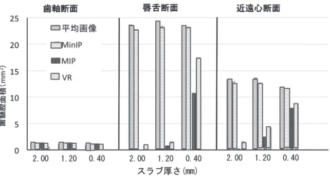 図 4 　スラブ厚さ1.20mm の平均値 MPR 断面像