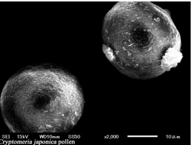 Fig. 1.1. The electron micrograph of cedar pollens. The pollen  is a sphere, and its diameter is about 30 micrometers.