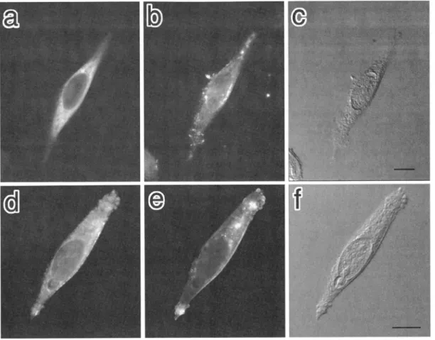 Figure 4    Effects of wotmannnin on subcellular distribution of GLUT4 in 