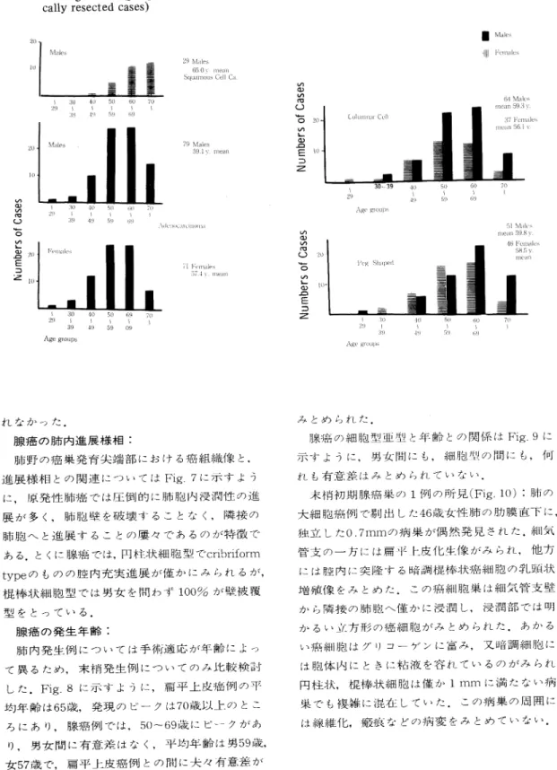 Fig.  8.  Age  distribution  and  histological  types of  lung  cancer  (peripheral  origin,   surgi-cally  resected  cases)