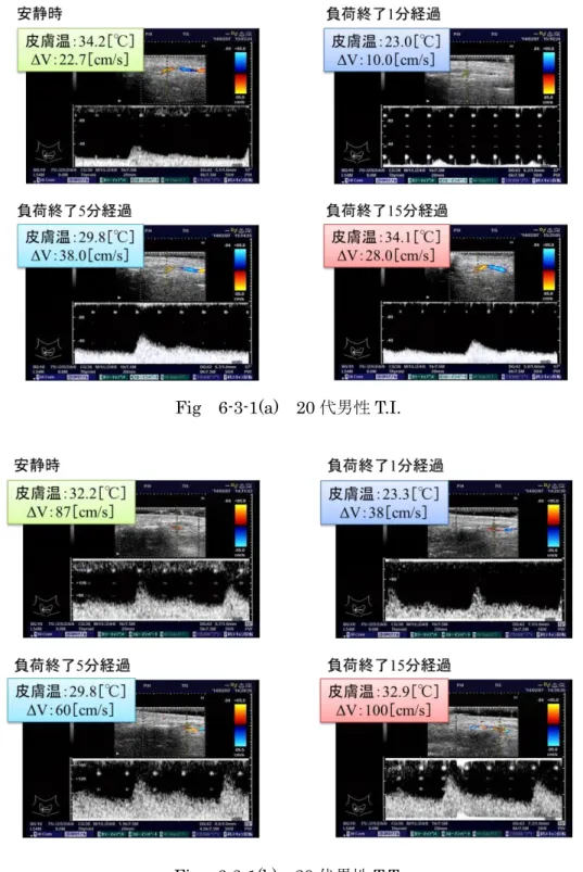 Fig  6-3-1(a)  20 代男性 T.I. 