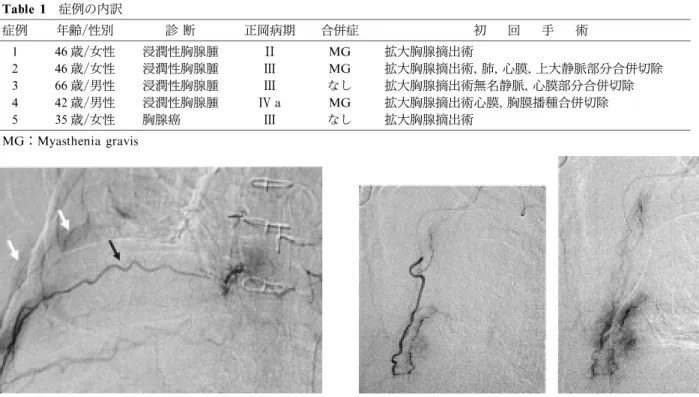 Fig. 1b   Angiogram of thoraco ‑ dorsal artery(left)and tumor stein (right).  Table 1症例の内訳症例年齢/性別診 断正岡病期合併症初回手 術1  46歳/女性浸潤性胸腺腫ⅡMG拡大胸腺摘出術2  46歳/女性浸潤性胸腺腫ⅢMG拡大胸腺摘出術,肺,心膜, 上大静脈部分合併切除3  66歳/男性浸潤性胸腺腫Ⅲなし拡大胸腺摘出術無名静脈,心膜部分合併切除4  42歳/男性浸潤性胸腺腫Ⅳa MG拡大胸腺摘出術心膜,胸膜播種合併切除5