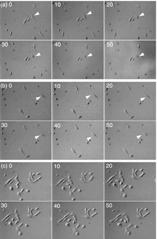 Figure 2 Time-lapse images of myocyte in the different mediums. (a);DMEM ＋ 10% HS,(b);Ringer solution,(c);