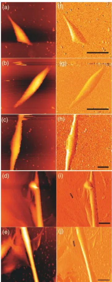Figure 3 Toporographic(a-e)and error signal images (f-j)of myocyte in Ringer solution containing 10% HS at 37℃.