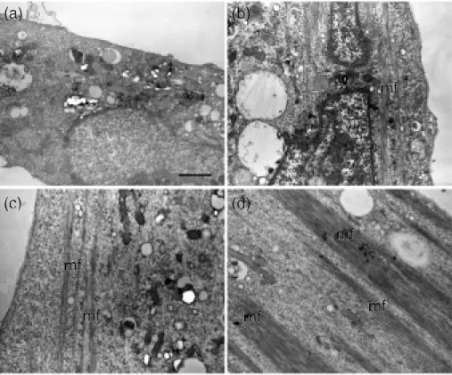 Figure 7 Electron micrographs of myocyte. (a);cultured at 2 days,(b);3 days,(c);4 days,(d);5 days
