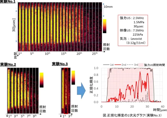 Fig. 7-2(a)  Levovist の T 画像 