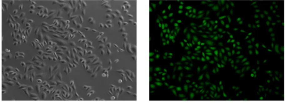図 5　Fluo 4 取り込み後の細胞写真　（左：明視野／右：蛍光）