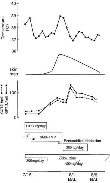 Fig.  4  Graphs  of  the  clinical  course  show  that  the  fever,  skin  rash,  and  liver  dysfunction  occurred  after  SMX-TMP  administration  began  and  resolved  after  SMX-TMP  administration  was  stopped.