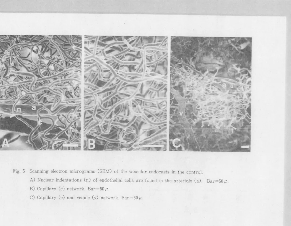 Fig .  5  Scanning  electron  m1crograms  (SEM)  of  th e  vascular  endocasts  in  the  control