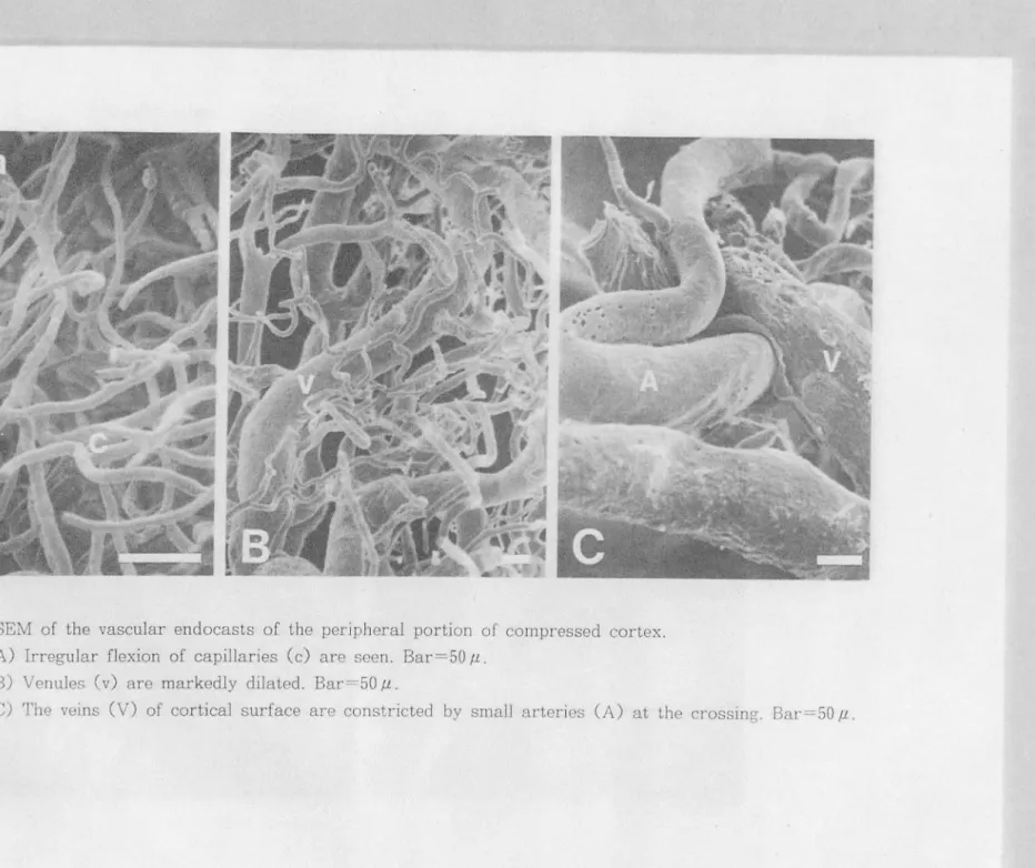 Fig.  7  SEM  of  the  vascular  endocasts  o f  t he  per ipheral  portion  of  compressed  cortex