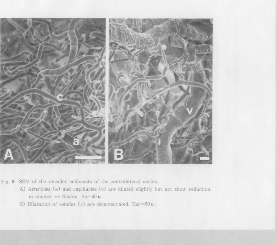 Fig.  8  SElv!  of  the  vascular  endocasts  of  the  contralateral  cortex. 