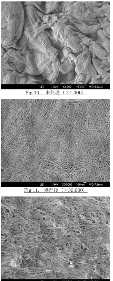 Fig 10.  未処理（×1,000） 