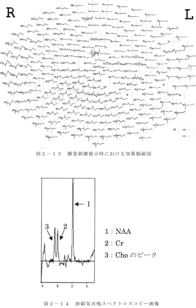 図 ２ － １ ３   聴 覚 刺 激 提 示 時 に お け る 加 算 脳 磁 図    
