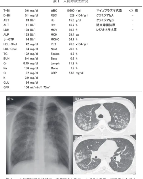 表 1 入院時検査所見 図1a 図1ｂ 図1ｂ 図 1a: 入院時胸部単純写真。両側びまん性にすりガラス陰影，両側胸水を認め た。図 1b: 入院時胸部単純 CT。図 1a に一致するように両側びまん性に 小葉中心性陰影主体に浸潤影・すりガラス陰影を認め，両側胸水も認め た。広義間質の肥厚はない。球上昇，CRP上昇 (表 1)画像所見：図1a, b  に示す通り，胸部単純写真では，両側びまん性にすりガラス陰影を認めた。胸部単純CTでは小葉中心性陰影主体の浸潤影・すりガラス陰影，及び両側胸水を認めた。明らかな