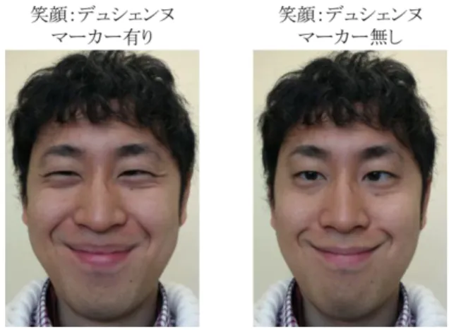 Figure 1  二種類の笑顔 