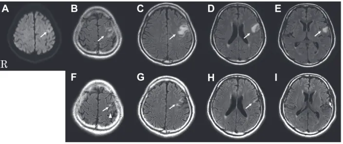 Fig. 1 Brain MRI.