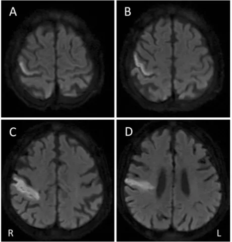 Fig. 1 Brain MRI findings on admission.